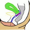 Diagram tampon iserted