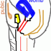Vaginismus Animated Picture (small)