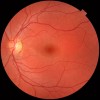 Image showing fundus of left eye important place to directly see the condition of blood vessels of the body.