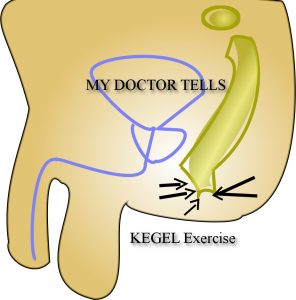 alternate contraction and relaxation of pelvic floor is kegel exercise