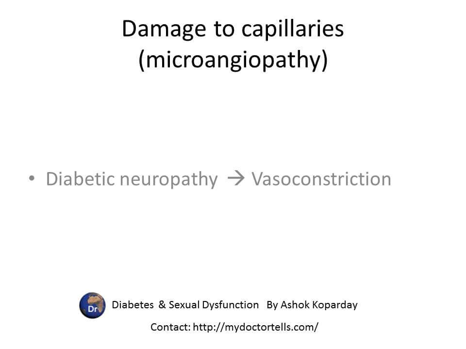 Damage to capillaries (microangiopathy) Diabetic neuropathy constriction  best sexologist Ashok Koparday
